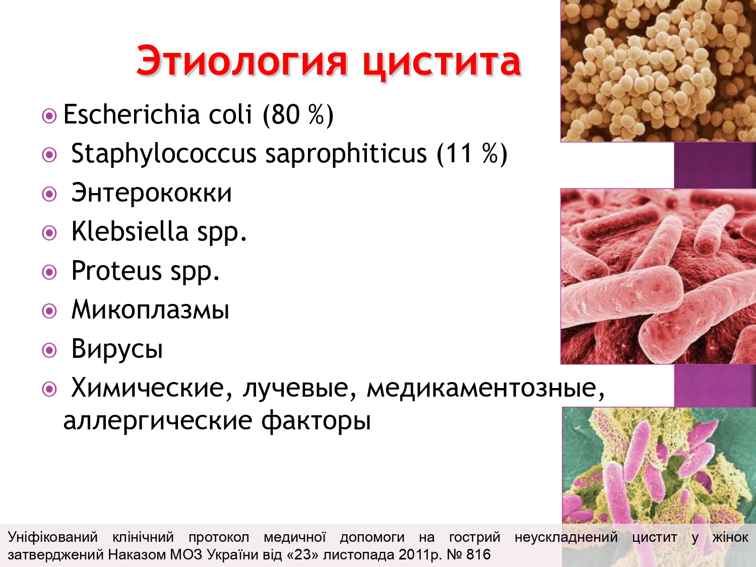 Escherichia coli что это у мужчин. Цистит этиология. Острый цистит этиология. Цистит этиология и патогенез. Острый цистит патогенез.